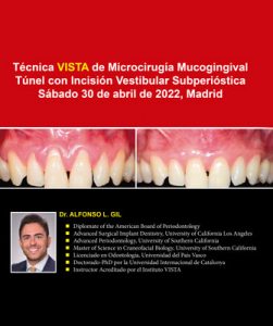 Técnica VISTA de Microcirugía Mucogingival Túnel con Incisión Vestibular Subperióstica