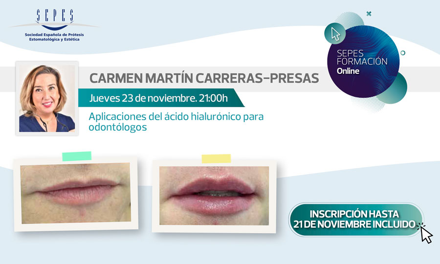 Carmen Martín Carreras-Presas