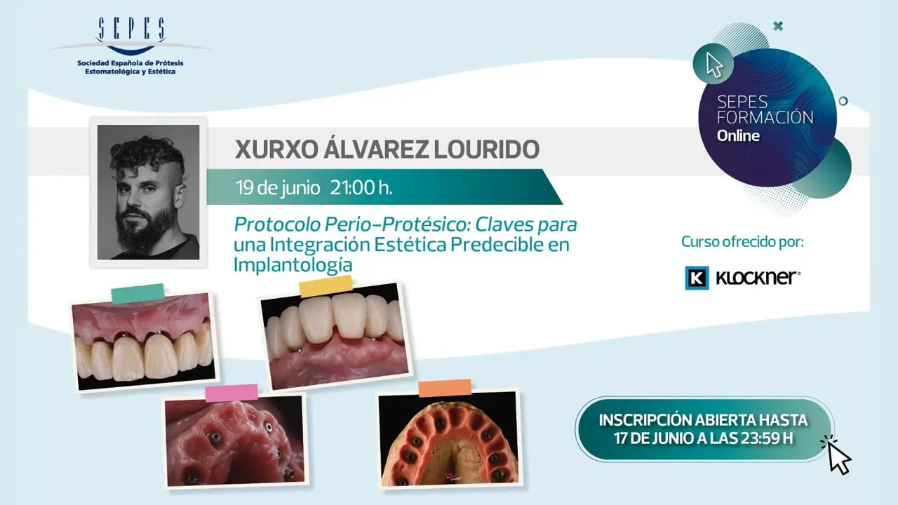 Protocolo Perio-Protésico: Claves para una Integración Estética Predecible en Implantología