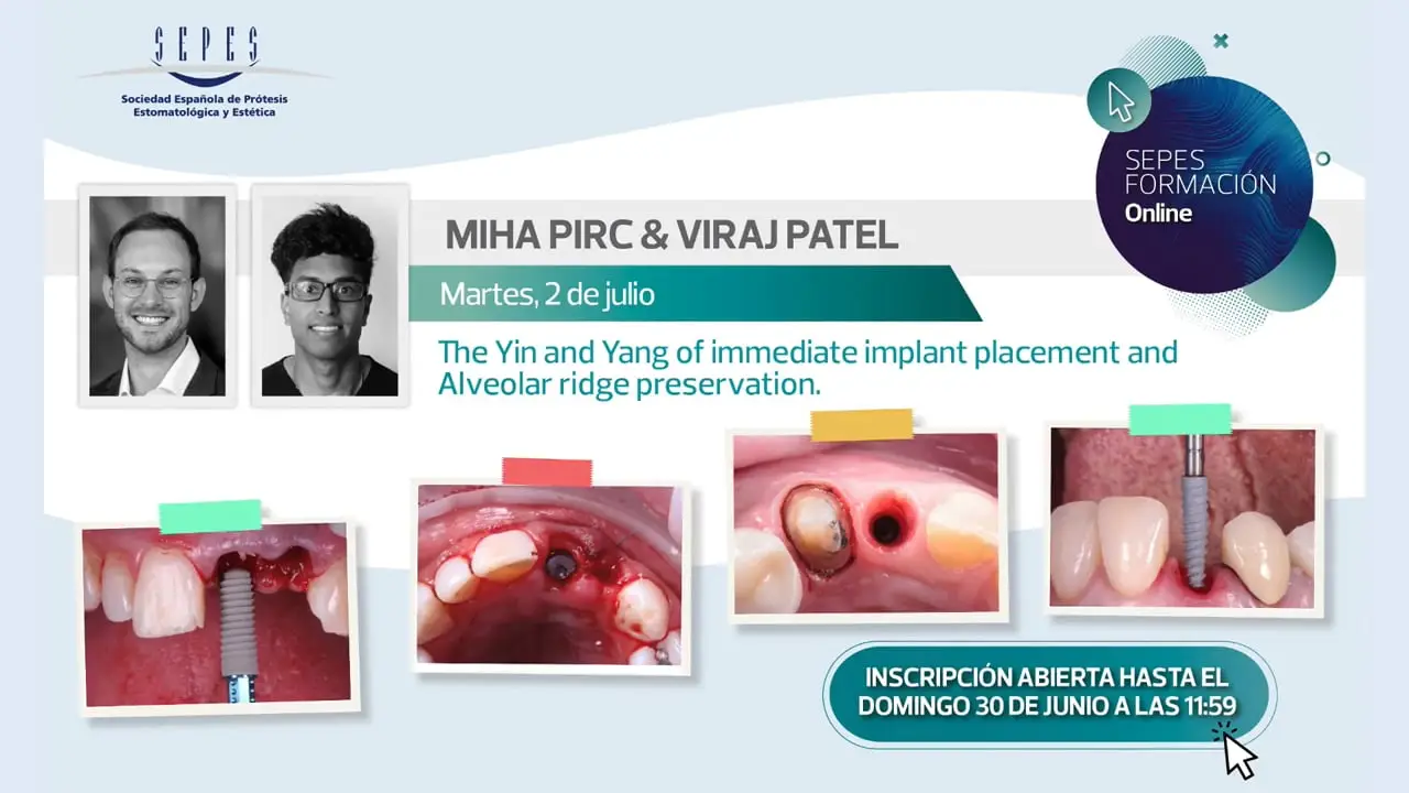 “The Yin and Yang of immediate implant placement and Alveolar ridge preservation”