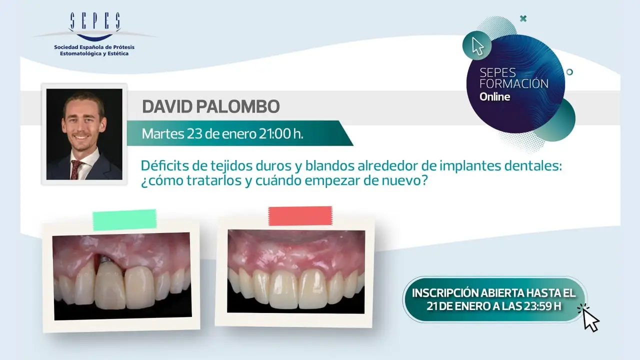 Déficits de tejidos duros y blandos alrededor de implantes dentales. ¿Cómo tratarlos y cuándo empezar de nuevo?