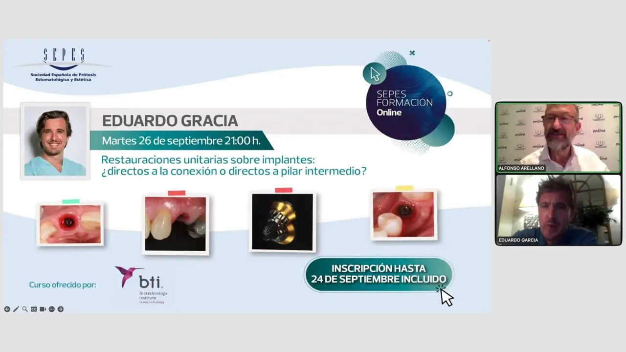 Restauraciones unitarias sobre implantes: ¿directos a la conexión o directos a pilar intermedio?