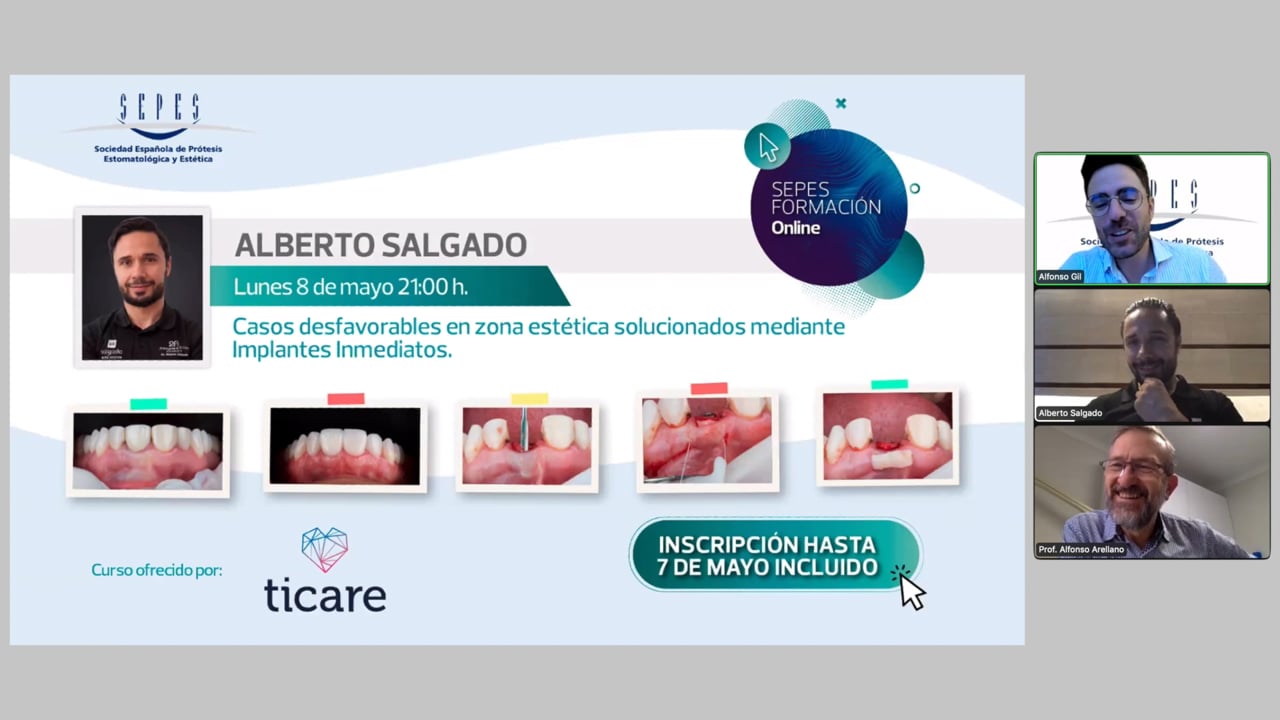 Casos desfavorables en zona estética solucionados mediante Implantes Inmediatos.