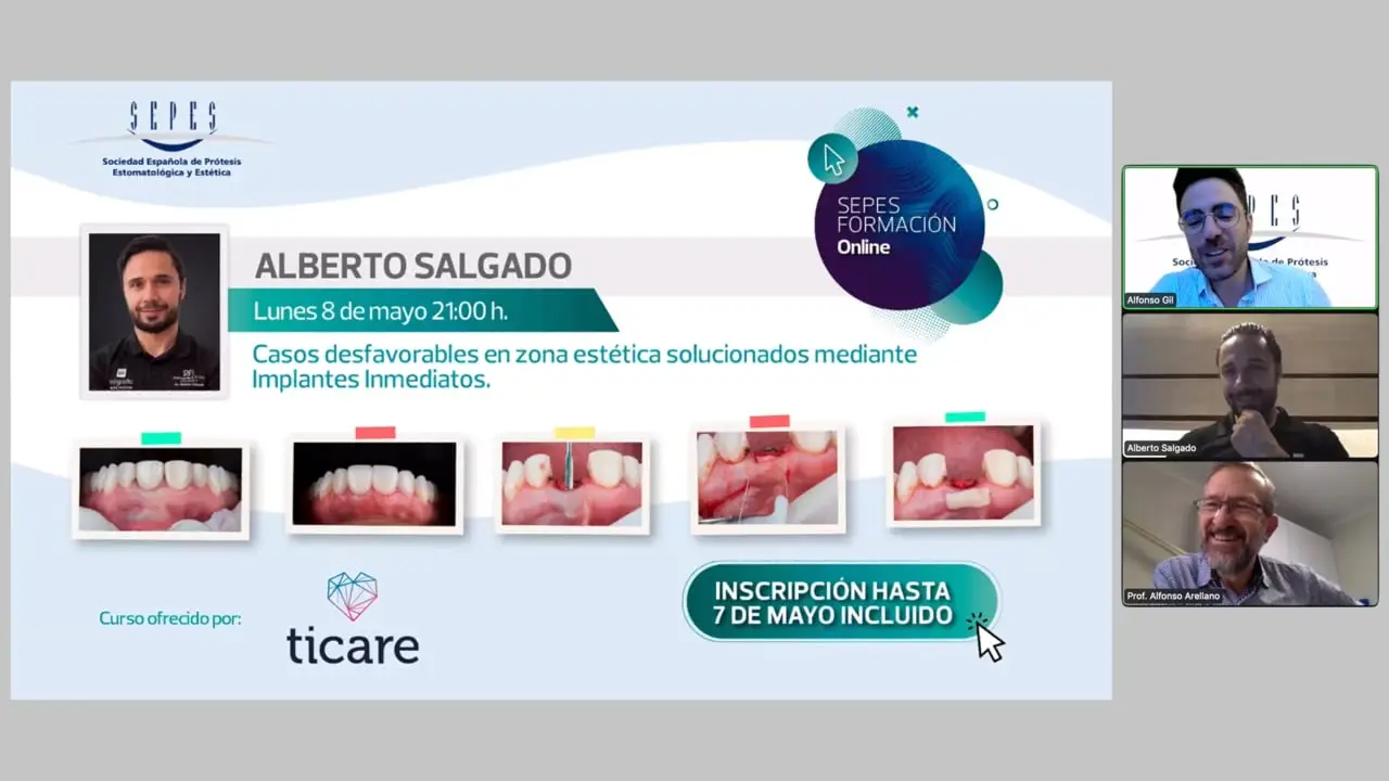 Casos desfavorables en zona estética solucionados mediante Implantes Inmediatos.