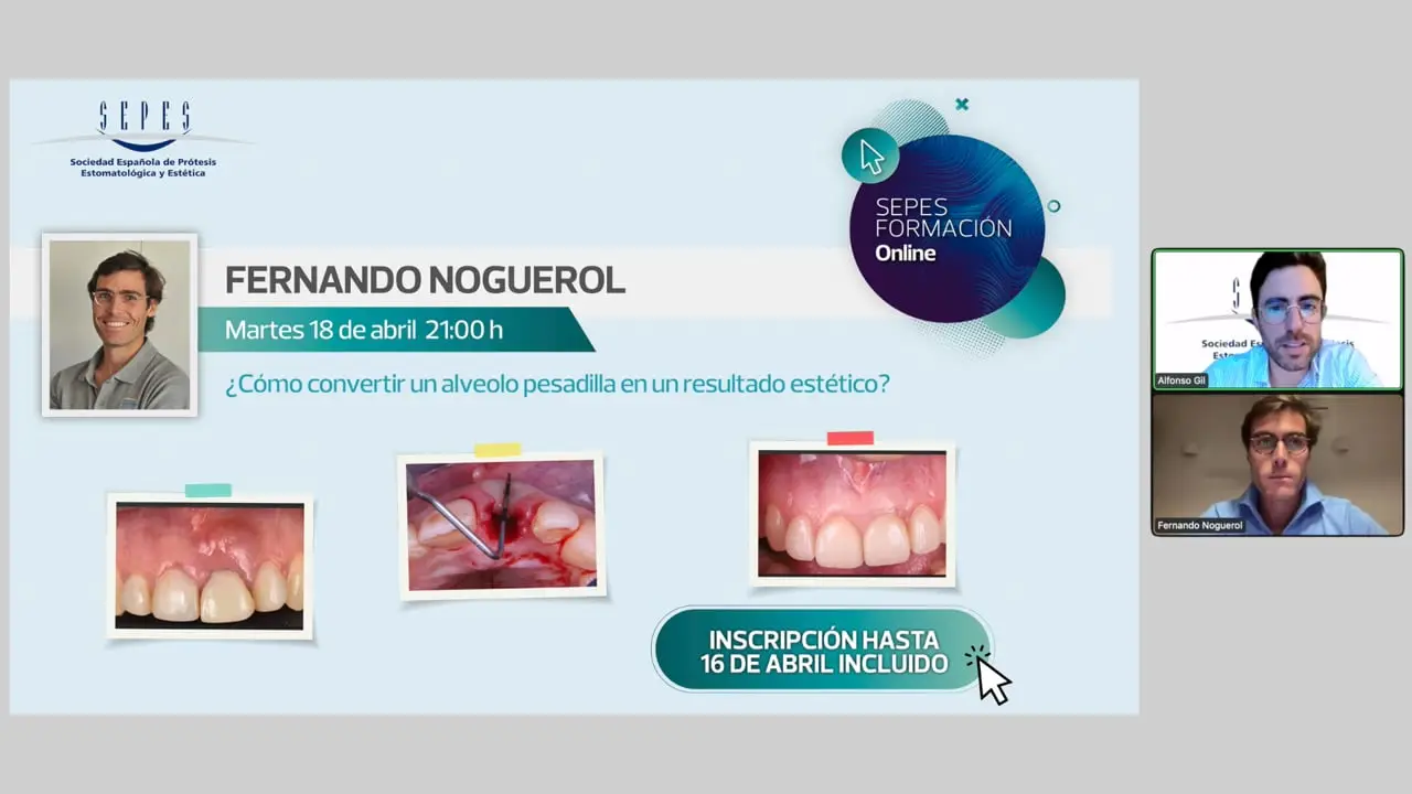 ¿Cómo convertir un alveolo pesadilla en un resultado estético?