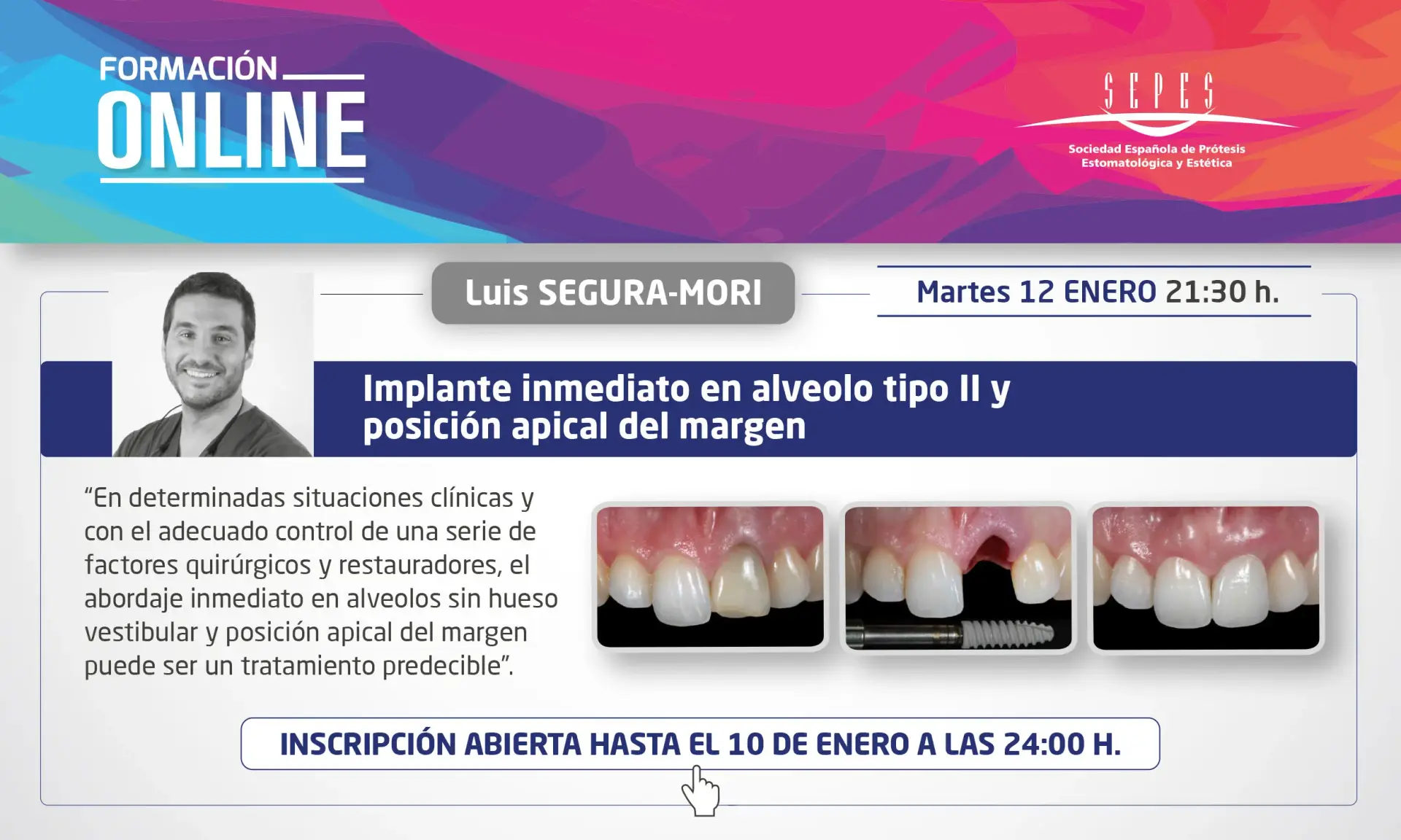 Implante inmediato alveolo tipo II y posición apical del margen.