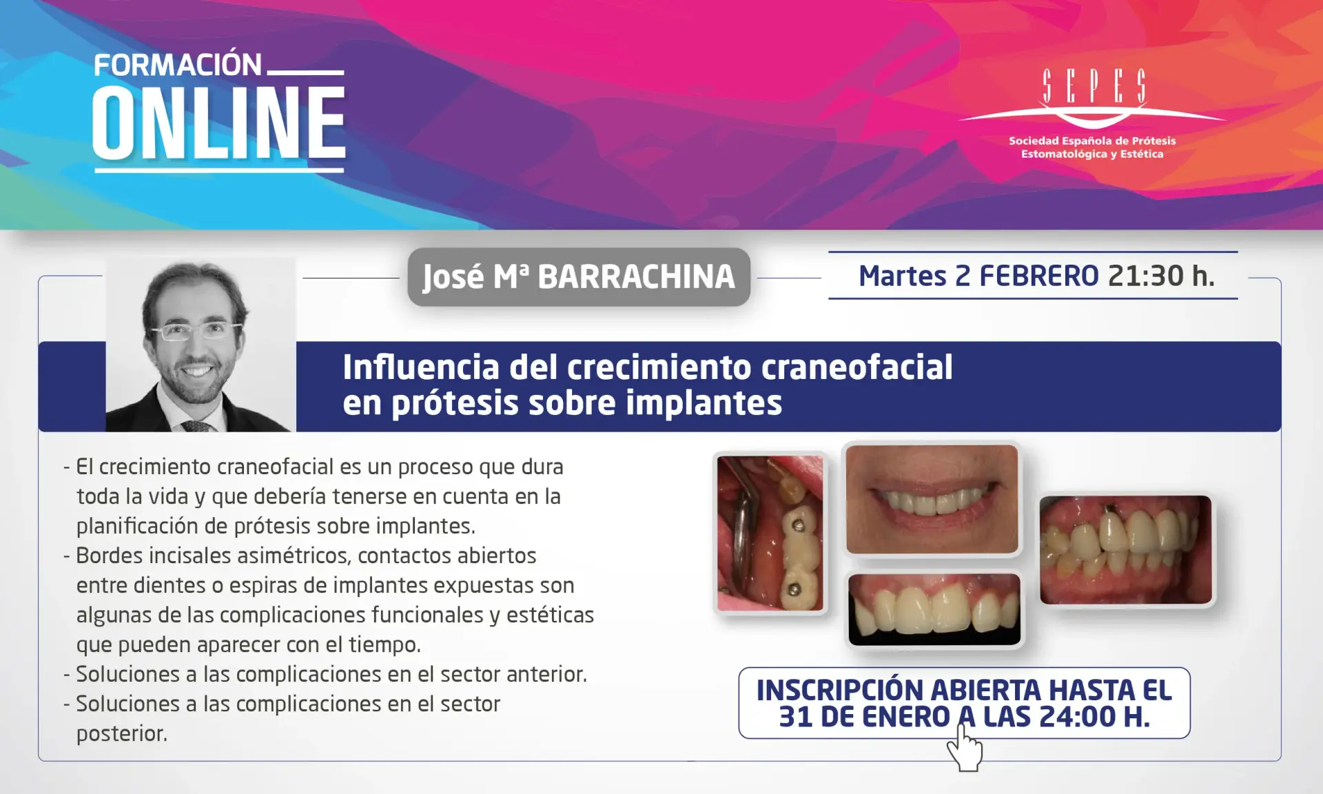 Influencia del crecimiento craneofacial en prótesis sobre implantes.