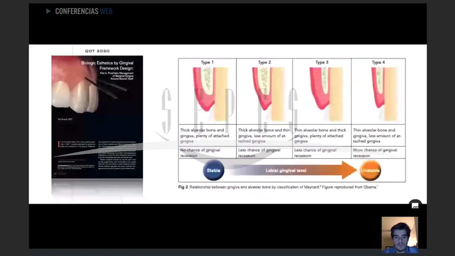 Perfil de emergencia en casos periodontales/BOPT.