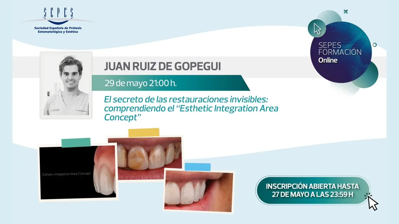 El secreto de las restauraciones invisibles: comprendiendo el Esthetic Integration Area Concept