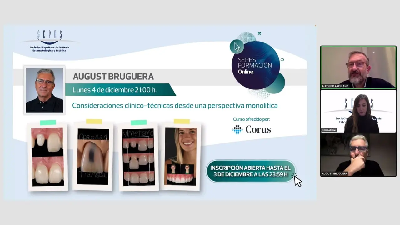 Consideraciones clínico-técnicas desde una perspectiva monolítica.
