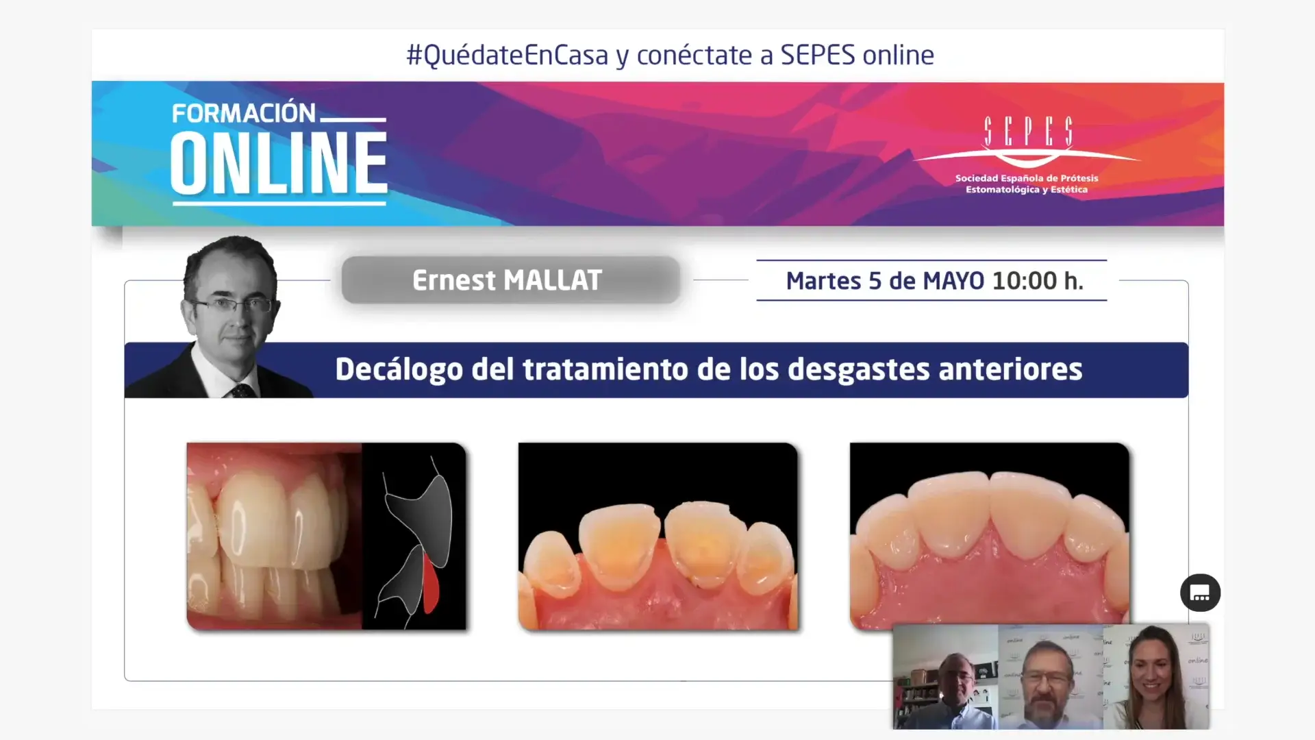 Decálogo del tratamiento de los desgastes anteriores.