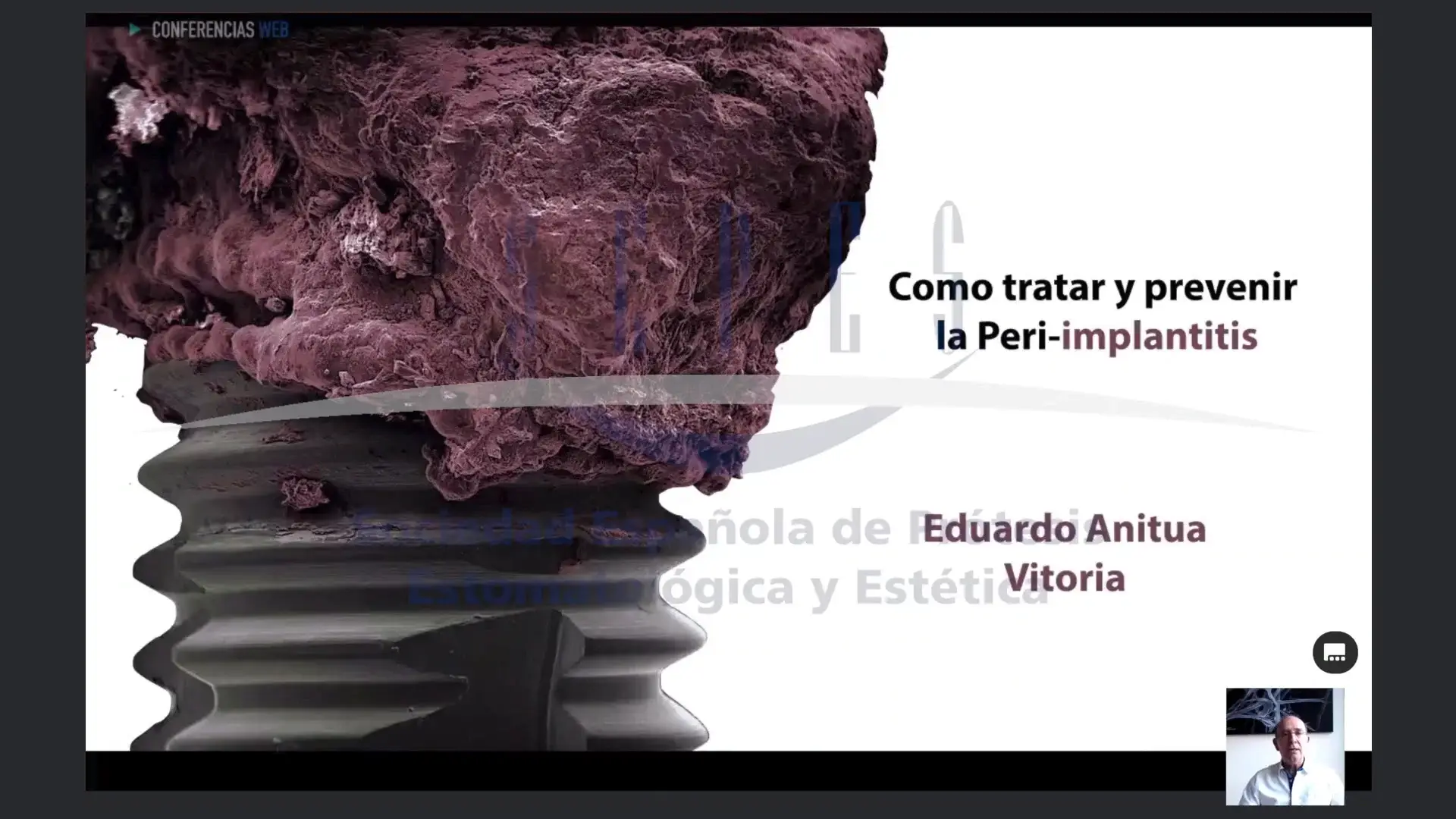Cómo tenemos que enfocar la periimplantitis desde un punto de vista prostodóntico y desde un punto de vista quirúrgico.