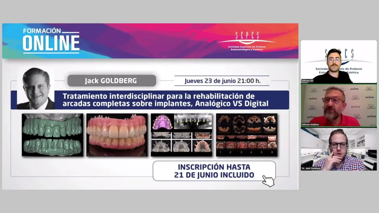 Tratamiento interdisciplinario para la rehabilitación de arcadas completas sobre implantes. Analógico VS Digital.
