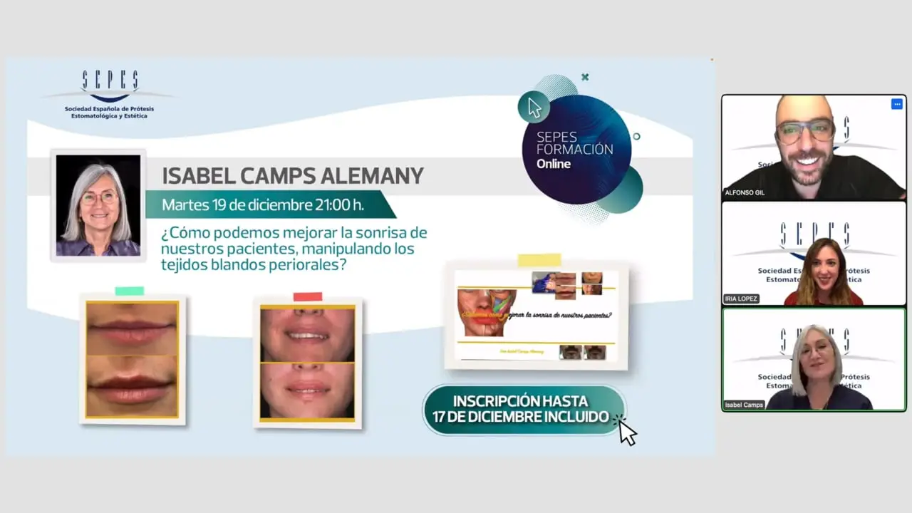 ¿Cómo podemos mejorar la sonrisa de nuestros pacientes, manipulando los tejidos blandos periorales?