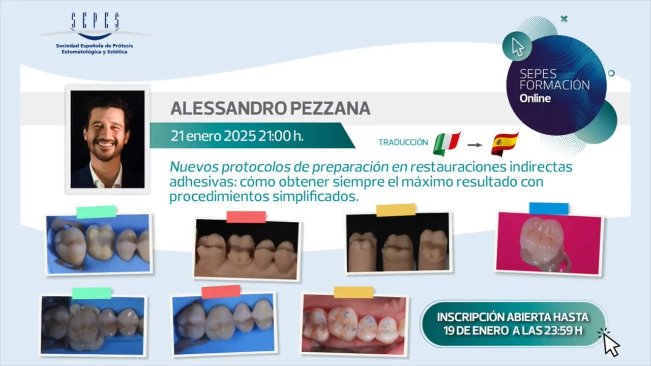 Nuevos protocolos de preparación en restauraciones indirectas adhesivas: cómo obtener siempre el máximo resultado con procedimientos simplificados