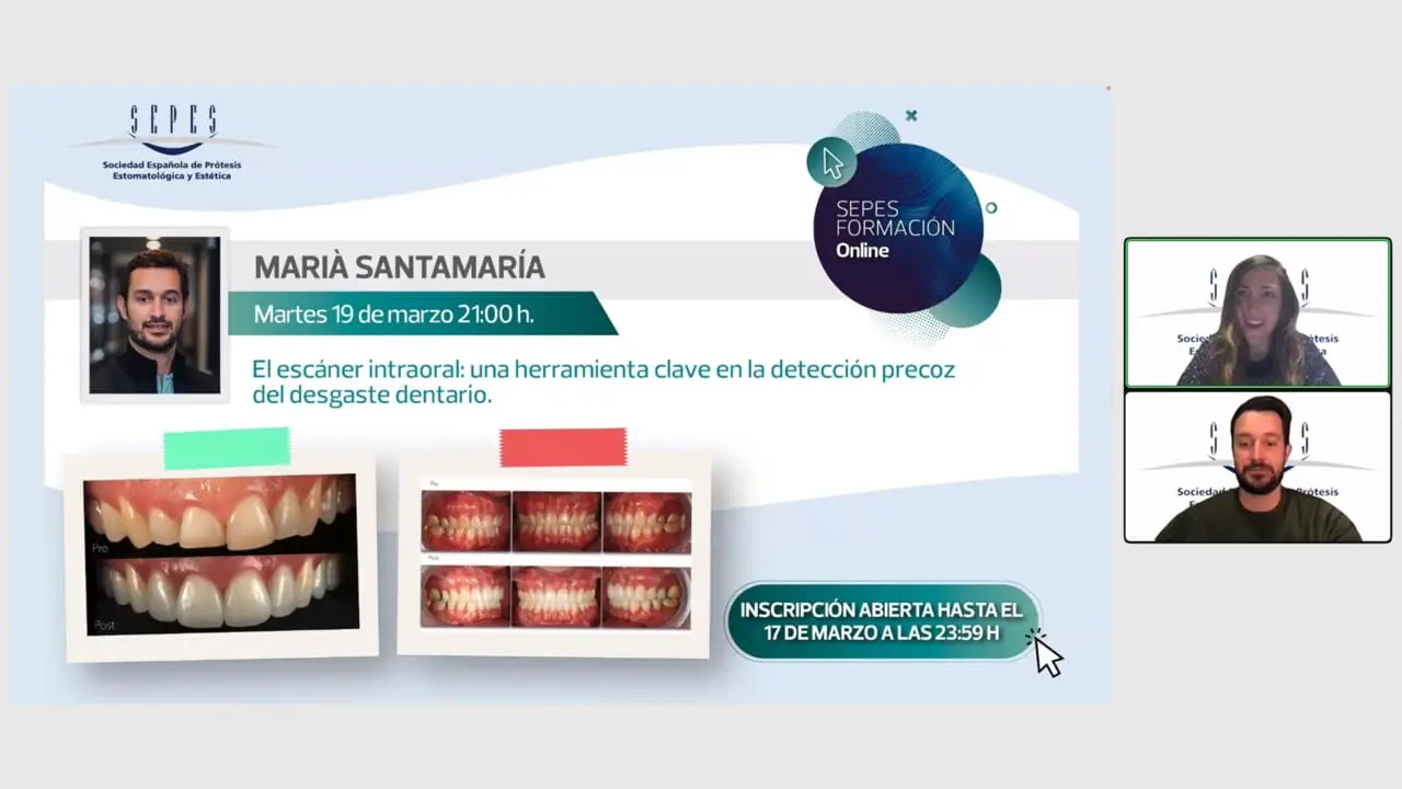 El escáner intraoral una herramienta clave en la detección precoz del desgaste dentario.