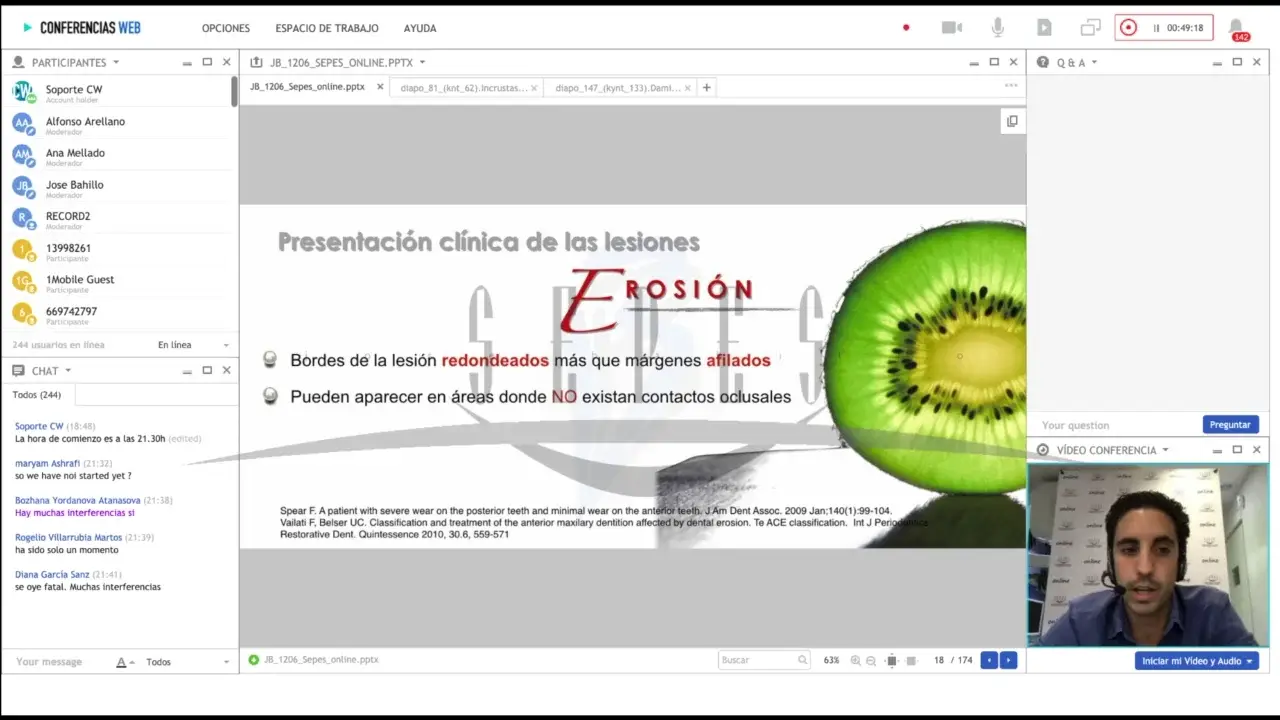 Rehabilitación Adhesiva Estéticamente Guiada en Pacientes con Desgaste Dental.