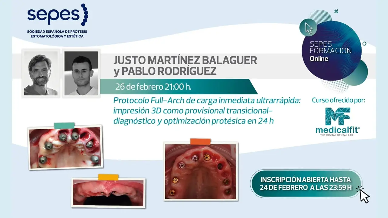 Protocolo full-arch de carga inmediata ultrarrápida: impresión 3D como provisional transicional-diagnóstico y optimización protésica en 24hs