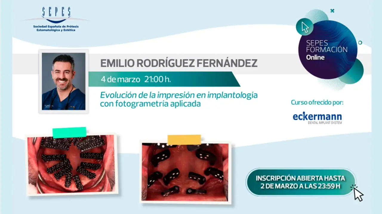 “Evolución de la impresión en implantología con fotogrametría aplicada”