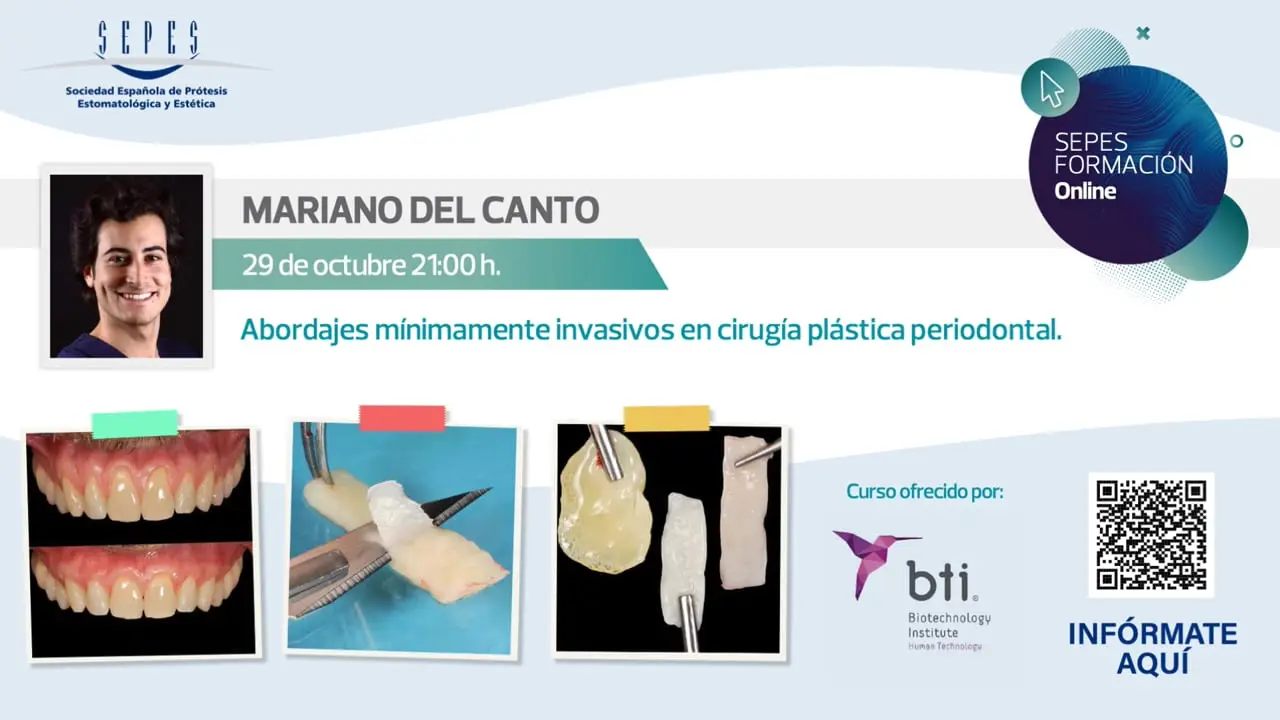 Abordajes mínimamente invasivos en cirugía plástica periodontal