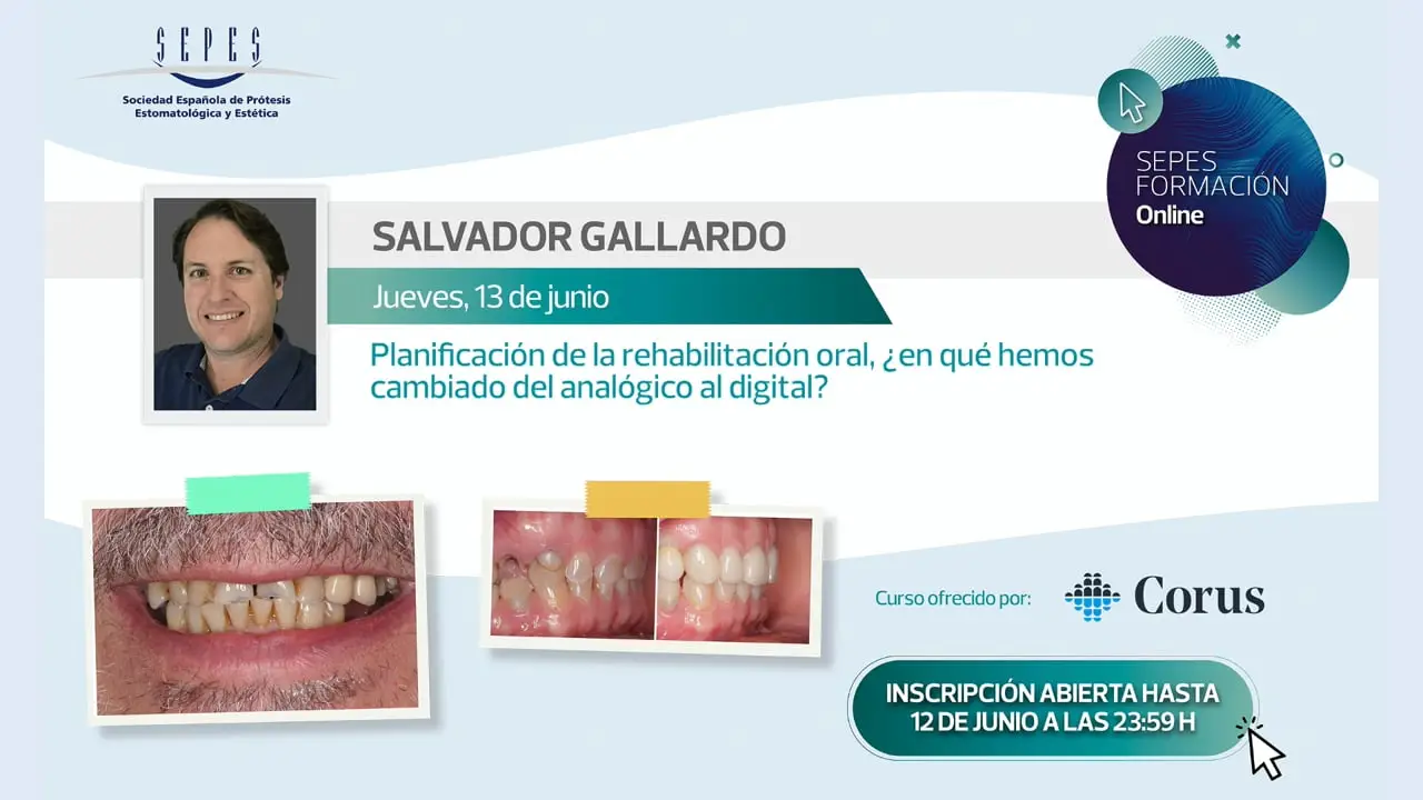 Planificación de la rehabilitación oral, ¿en qué hemos cambiado del analógico al digital?