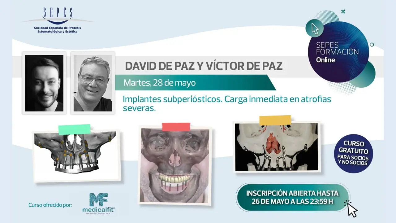 Implantes subperiósticos. Carga inmediata en atrofias severas.