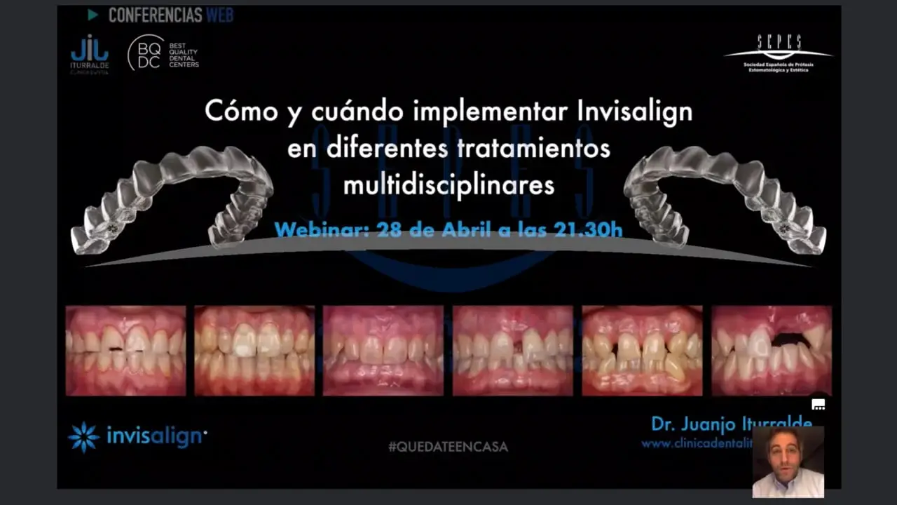 Cómo y cuándo implementar Invisalign en diferentes tratamientos multidisciplinares.