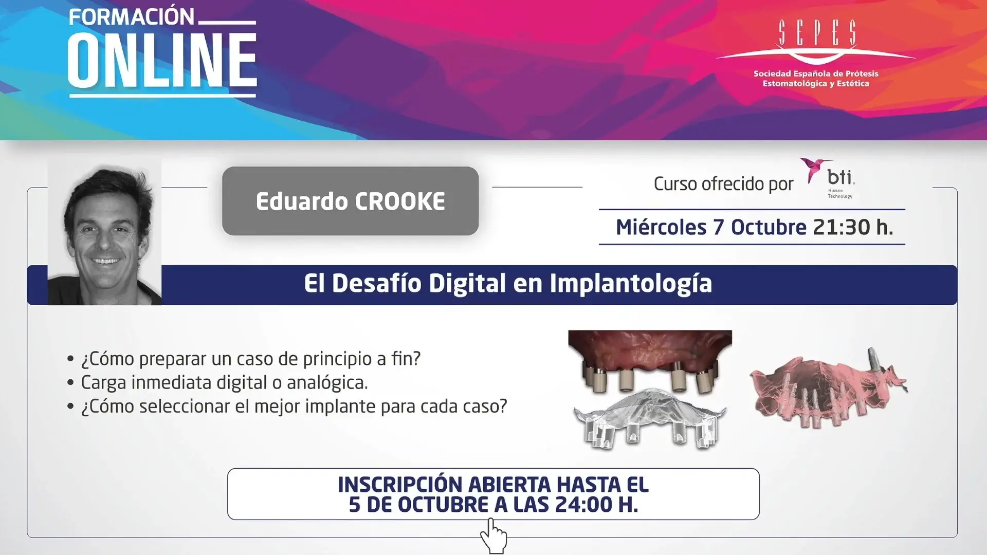 El desafío digital en Implantología.