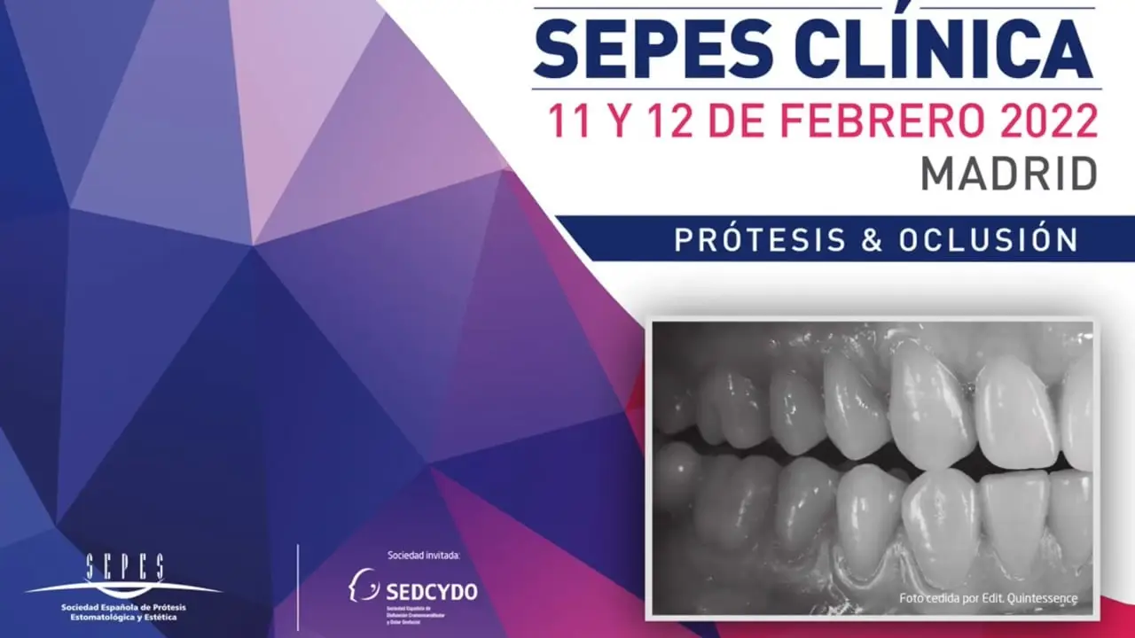 Trastornos temporomandibulares y dispositivos de avance mandibular en el paciente con ronquido y apnea obstructiva del sueño (AOS).